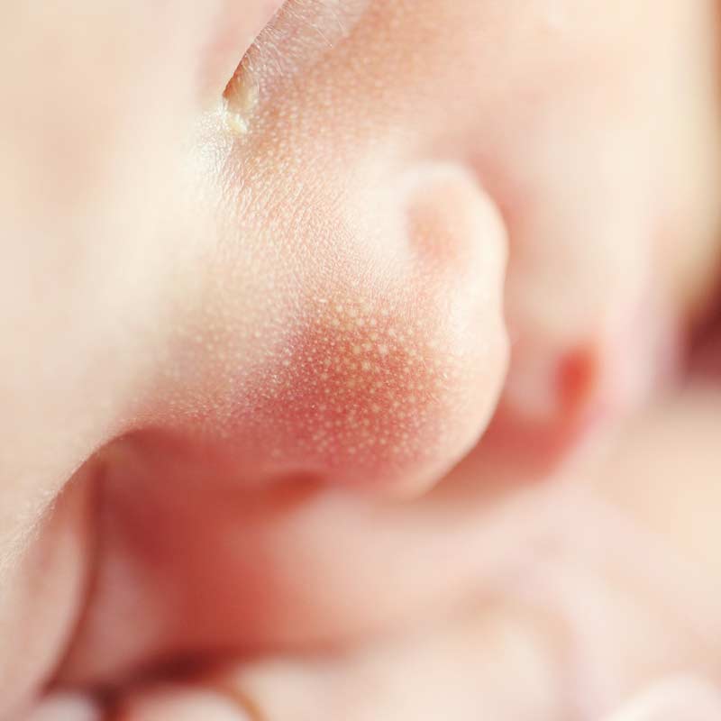Child's Well Visit, 1 Month: Pre-Visit Questionnaire