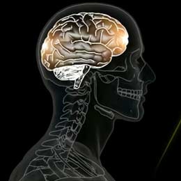 What is a concussion?