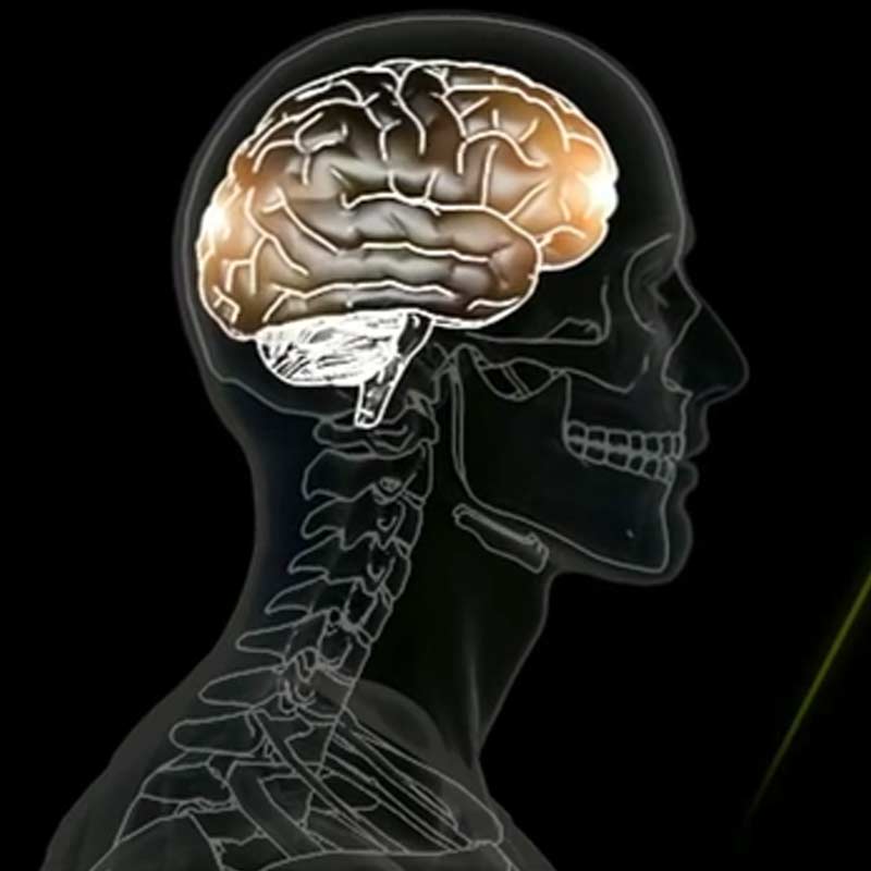 What is a concussion?